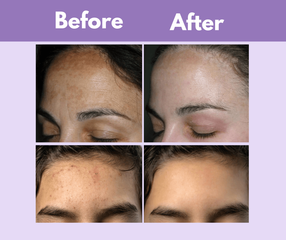 LED Face Mask – Led therapy Mask