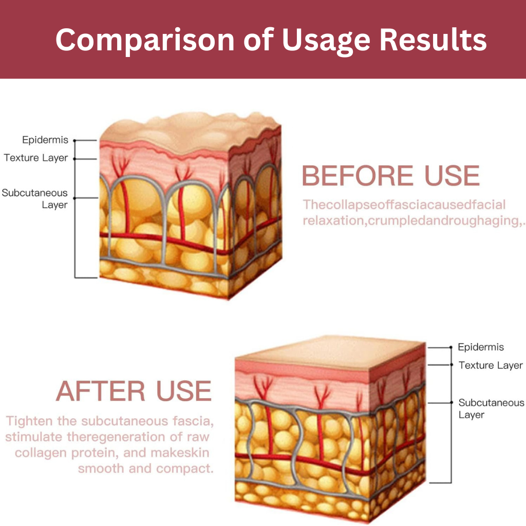 Visible results from using a HIFU device, showing improved skin firmness, reduced wrinkles, and a more lifted, youthful appearance.