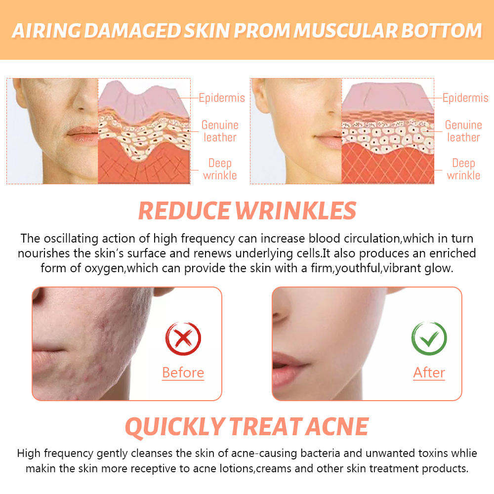 4 in 1 High Frequency Facial Wand Machine – Home and Salon Use Skin Care Tool for Acne, Wrinkles and Pigmentation