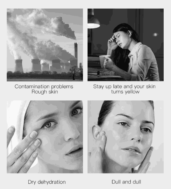 It's Zara Skin Detoxifying Charcoal & Aloe Mask