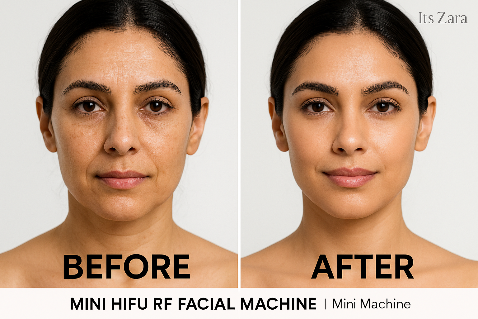 RF mini HIFU facial machine helps tighten skin, reduce wrinkles, lift sagging areas, and improve a youthful glow.
