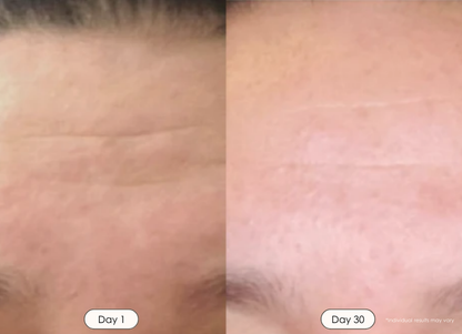 7 Lasers  LED therapy Mask | Rechargeable LED face mask