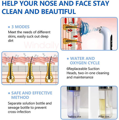 It’s Zara Balck Head Remover | water tank technology | Rechargeable Micro Bubble Face Vacuum Pore Cleanser Blackhead Remover With Water