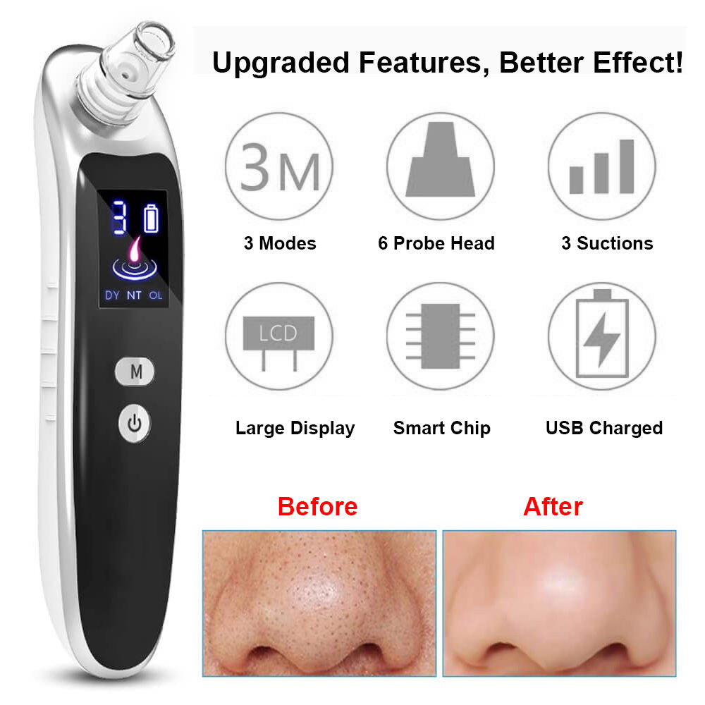 Blackhead removal device with 3 modes, 6 probe heads, USB charging, large display, and before/after nose results
