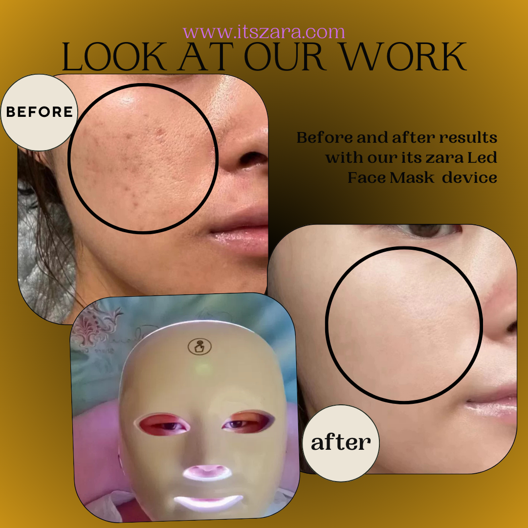 7 Lasers  LED therapy Mask | Rechargeable LED face mask