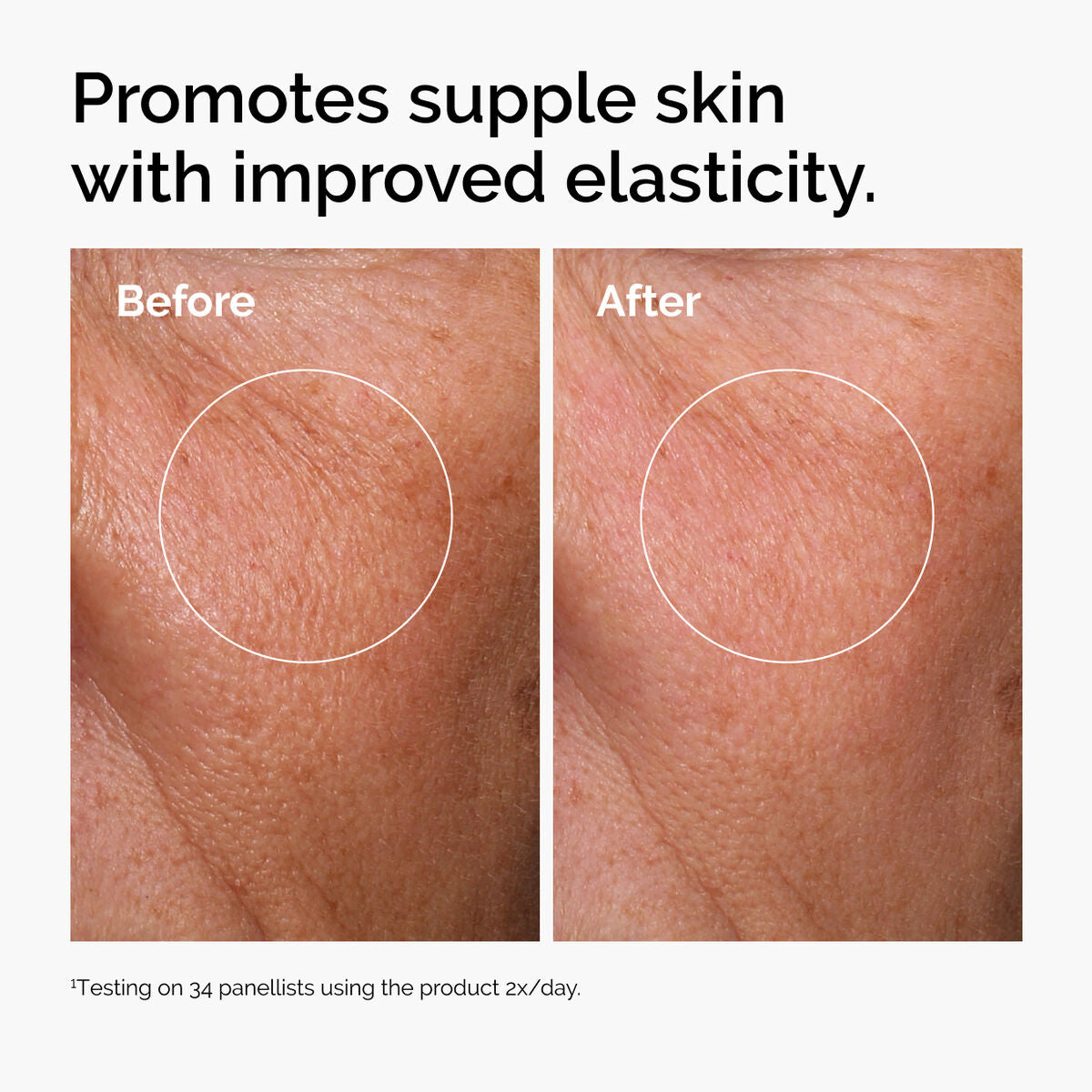 Before and after using The Ordinary product: shows improved skin elasticity and smoother skin texture